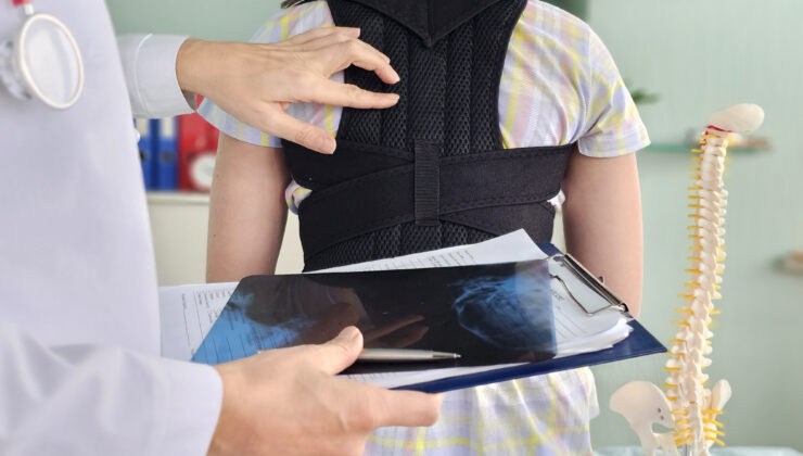 Omuz eşitsizliği ve sırt çıkıntısına dikkat: Skolyoz sessiz ilerliyor
